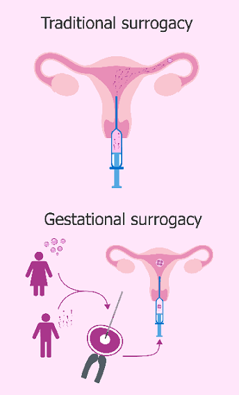Surrogacy Process in Ukraine
